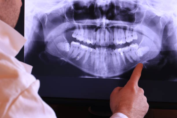 Best Holiday Emergency Dentist in Navasota, TX